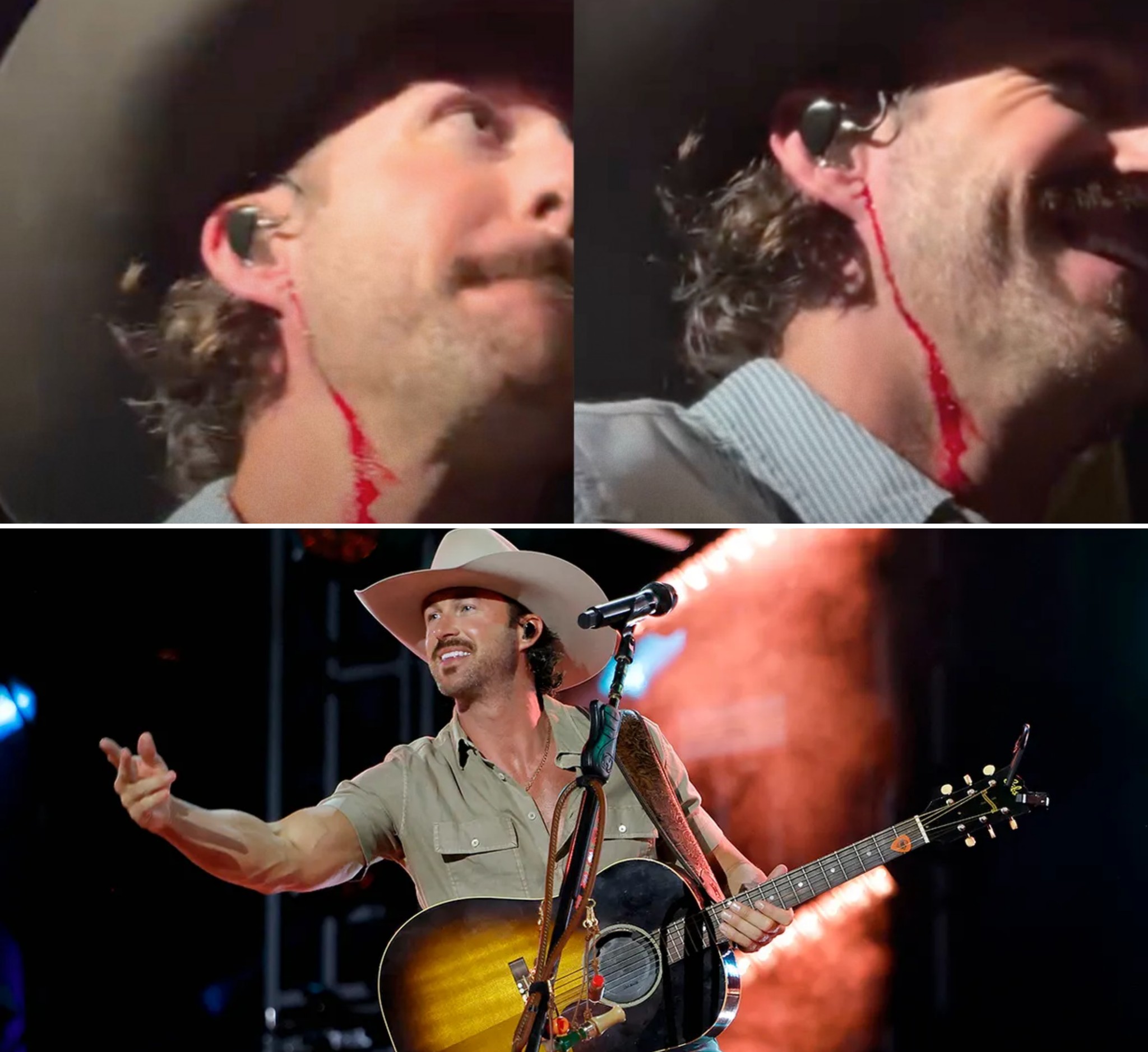 Riley Green Left Bleeding on Stage After Fan Hurls Phone at His Face During Melbourne Concert – Singer Demands “Get His Ass Out of Here” as Chaos Erupts